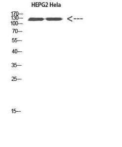 Western blot analysis of HEPG2 Hela cells using Anti-RET Antibody