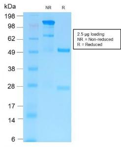 SDS-PAGE analysis of Anti-MMP9 Antibody [MMP9/2025R] under non-reduced and reduced conditions; showing intact IgG and intact heavy and light chains, respectively. SDS-PAGE analysis confirms the integrity and purity of the Antibody