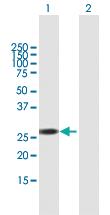 Anti-RBM38 Mouse Polyclonal Antibody