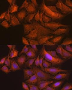 Immunofluorescence analysis of U-2 OS cells using Anti-NAK / TBK1 Antibody [ARC0778] (A307679) at a dilution of 1:100 (40x lens). DAPI was used to stain the cell nuclei (blue).