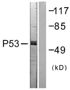 Western blot analysis of lysates from 293 cells, treated with Etoposide 25uM 60' using Anti-p53 Antibody. The right hand lane represents a negative control, where the antibody is blocked by the immunising peptide.