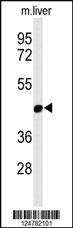 Anti-MMAA Rabbit Polyclonal Antibody