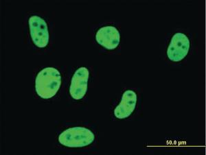 Anti-SMAD3 Mouse Monoclonal Antibody [clone: 4F9]