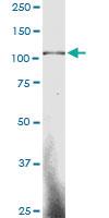 Anti-SP3 Mouse Monoclonal Antibody [clone: 3F2]