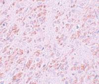 Anti-VENTX Rabbit Polyclonal Antibody