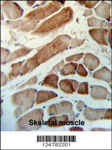 Anti-MMAA Rabbit Polyclonal Antibody