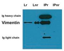 Anti-VIM Mouse Monoclonal Antibody [clone: VI-01]