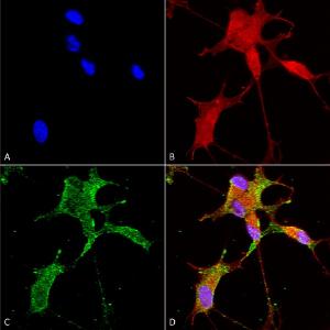 Immunocytochemistry/Immunofluorescence analysis of human neuroblastoma cells (SH-SY5Y), fixed in 4% PFA for 15  min, using Anti-CACNA1 h Antibody [N55/10] (A304750), at 1:50 for overnight at 4 °C with slow rocking.