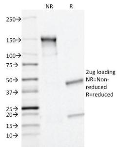 SDS-PAGE analysis of Anti-MRP1 Antibody [MRP1/1343] under non-reduced and reduced conditions; showing intact IgG and intact heavy and light chains, respectively. SDS-PAGE analysis confirms the integrity and purity of the antibody