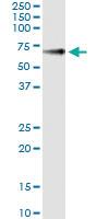 Anti-GPC5 Antibody Pair