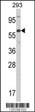 Anti-RELA Rabbit Polyclonal Antibody