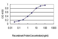 Anti-RNF139 Mouse Monoclonal Antibody [clone: 3D10]