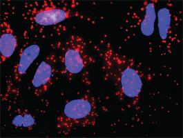 Anti-CALR + F8 Antibody Pair