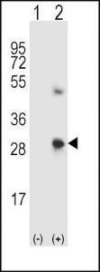 Anti-Osteonectin Rabbit Polyclonal Antibody