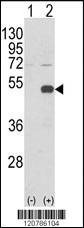 Anti-RELA Rabbit Polyclonal Antibody