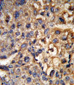 Anti-HSD17B12 Rabbit Polyclonal Antibody (AP (Alkaline Phosphatase))