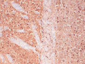 Immunohistochemistry analysis of human frozen brain section, fixed in 10% formalin solution for 12-24 hours at room temperature. The Primary Antibody used was Anti-CACNA1 h Antibody [N55/10] (A304750) at 1:1000 for 1 hour at room temperature