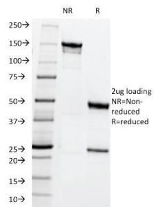 SDS-PAGE analysis of Anti-MRP1 Antibody [MRP1/1344] under non-reduced and reduced conditions; showing intact IgG and intact heavy and light chains, respectively. SDS-PAGE analysis confirms the integrity and purity of the Antibody