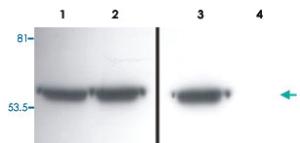 Anti-VIM Mouse Monoclonal Antibody [clone: VI-01]