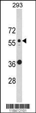 Anti-KRT10 Rabbit Polyclonal Antibody (AP (Alkaline Phosphatase))