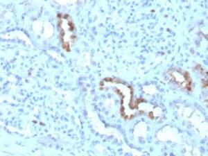 Immunohistochemical analysis of formalin-fixed, paraffin-embedded human kidney using Anti-Calbindin Antibody [CALB1/3333]