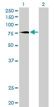 Anti-PRKCD Mouse Monoclonal Antibody [clone: 6A2]