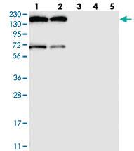 Anti-GPR158 Rabbit Polyclonal Antibody