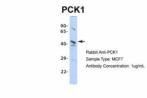 Anti-PCK1 Rabbit Polyclonal Antibody