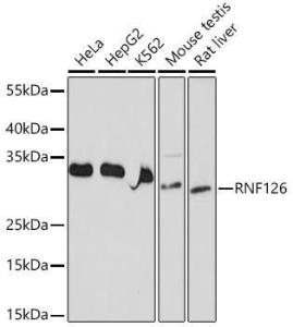 Anti-RNF126 antibody