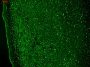 Immunohistochemistry analysis of human hippocampus, fixed in Bouin's fixative solution and paraffin-embedded. The Primary Antibody used was Anti-CACNA1 h Antibody [N55/10] (A304750) at 1:1000 for 1 hour at room temperature.