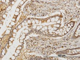 Anti-NMI Mouse Monoclonal Antibody [clone: 9E8]