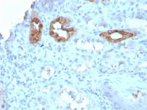 Immunohistochemical analysis of formalin-fixed, paraffin-embedded human kidney using Anti-Calbindin Antibody [CALB1/3333]