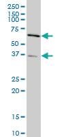 Anti-SMAD3 Mouse Monoclonal Antibody [clone: 2G4]