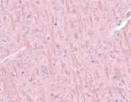 Anti-CCDC106 Rabbit Polyclonal Antibody