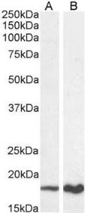 Anti-Cdkn2a Antibody (A82613) (0.3 µg/ml) staining of Mouse (A) and Rat (B) Liver lysate (35 µg protein in RIPA buffer). Primary incubation was 1 hour. Detected by chemiluminescence