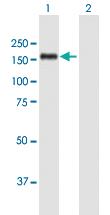 Anti-SMARCAD1 Mouse Polyclonal Antibody