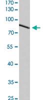 Anti-CDH17 Rabbit Polyclonal Antibody