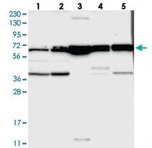 Anti-CLCC1 Rabbit Polyclonal Antibody