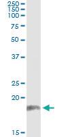 Anti-PPP2R3B Antibody Pair