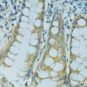 Anti-Cytochrome P450 2B6/CYP2B6 Rabbit Polyclonal Antibody