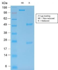 SDS-PAGE analysis of Anti-MMP9 Antibody [rMMP9/1769] under non-reduced and reduced conditions; showing intact IgG and intact heavy and light chains, respectively. SDS-PAGE analysis confirms the integrity and purity of the antibody