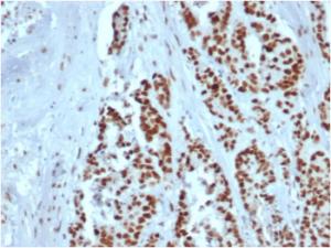 Immunohistochemical analysis of formalin-fixed, paraffin-embedded human colon using Anti-MSH2 Antibody [rMSH2/6548]