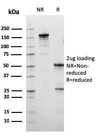 SDS-PAGE analysis of Anti-Calbindin Antibody [CALB1/3333] under non-reduced and reduced conditions; showing intact IgG and intact heavy and light chains, respectively. SDS-PAGE analysis confirms the integrity and purity of the antibody