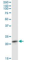 Anti-RAB11A Mouse Polyclonal Antibody