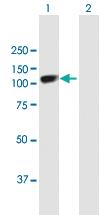 Anti-SOX6 Mouse Polyclonal Antibody