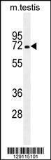 Anti-MBTD1 Rabbit Polyclonal Antibody (FITC (Fluorescein Isothiocyanate))