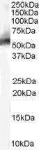 Anti-MDM2 Goat Polyclonal Antibody