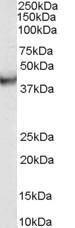 Anti-VPS37C Antibody (A84109) (003g/ml) staining of human duodenum lysate (35 µg protein in RIPA buffer) Primary incubation was 1 hour Detected by chemiluminescence