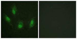 Immunofluorescence analysis of HeLa cells using Anti-p53 Antibody. The right hand panel represents a negative control, where the antibody was pre-incubated with the immunising peptide.