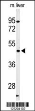 Anti-hPFTK1-M1 Rabbit Polyclonal Antibody